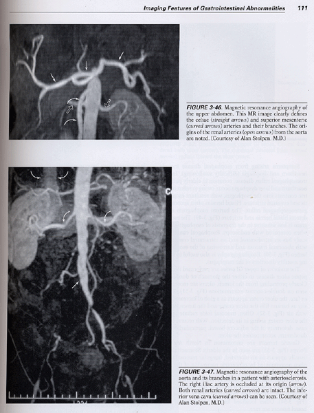 Radiology 101 The Basics and Fundamentals of Imaging ,2/e