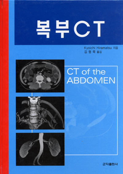 복부 CT [CT of the Abdomen]