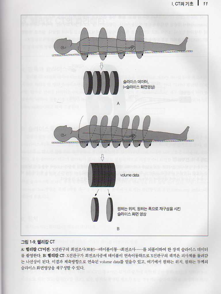 복부 CT [CT of the Abdomen]