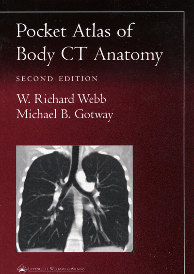 Pocket Atlas of Body CT Anatomy 2th