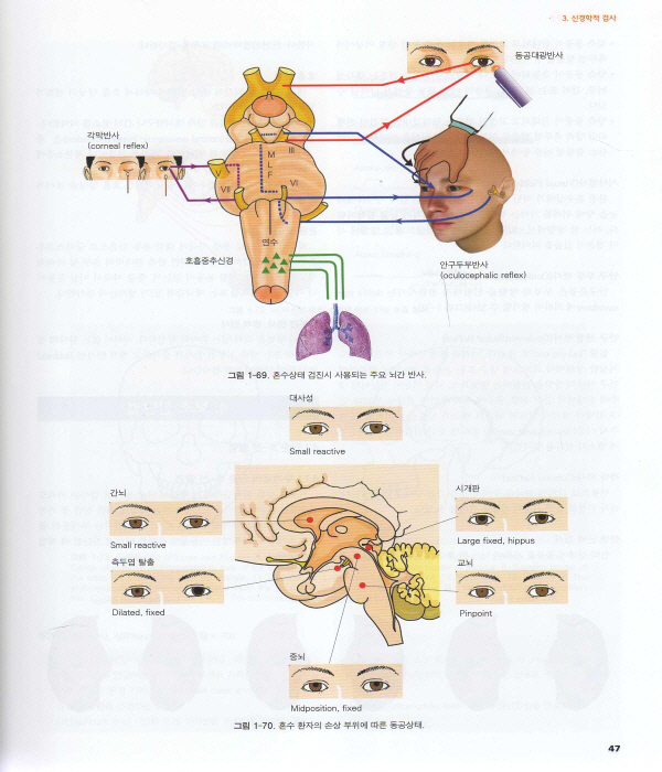 신경외과학 4판 