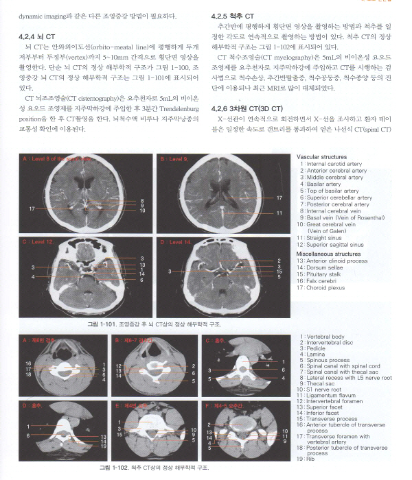 신경외과학 4판 