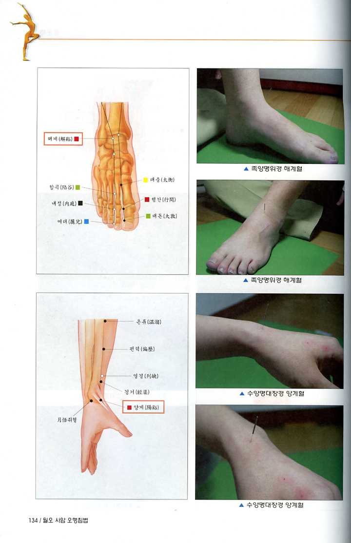 월오 사암오행침법 (일중사)