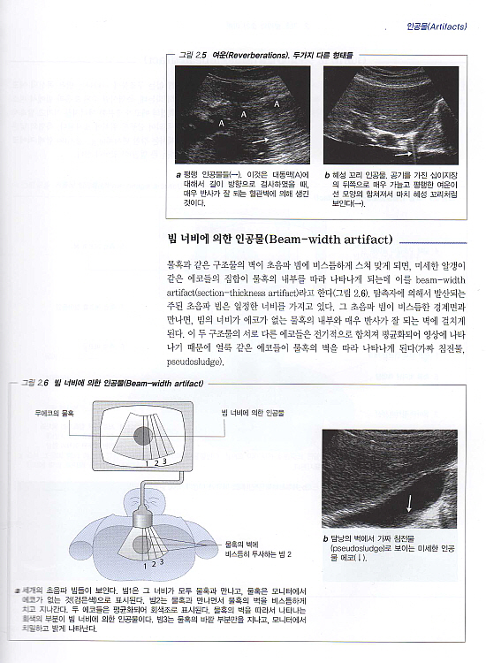 복부 초음파 진단 [복부스캔을 위한 단계적 안내서]