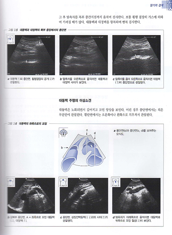 복부 초음파 진단 [복부스캔을 위한 단계적 안내서]