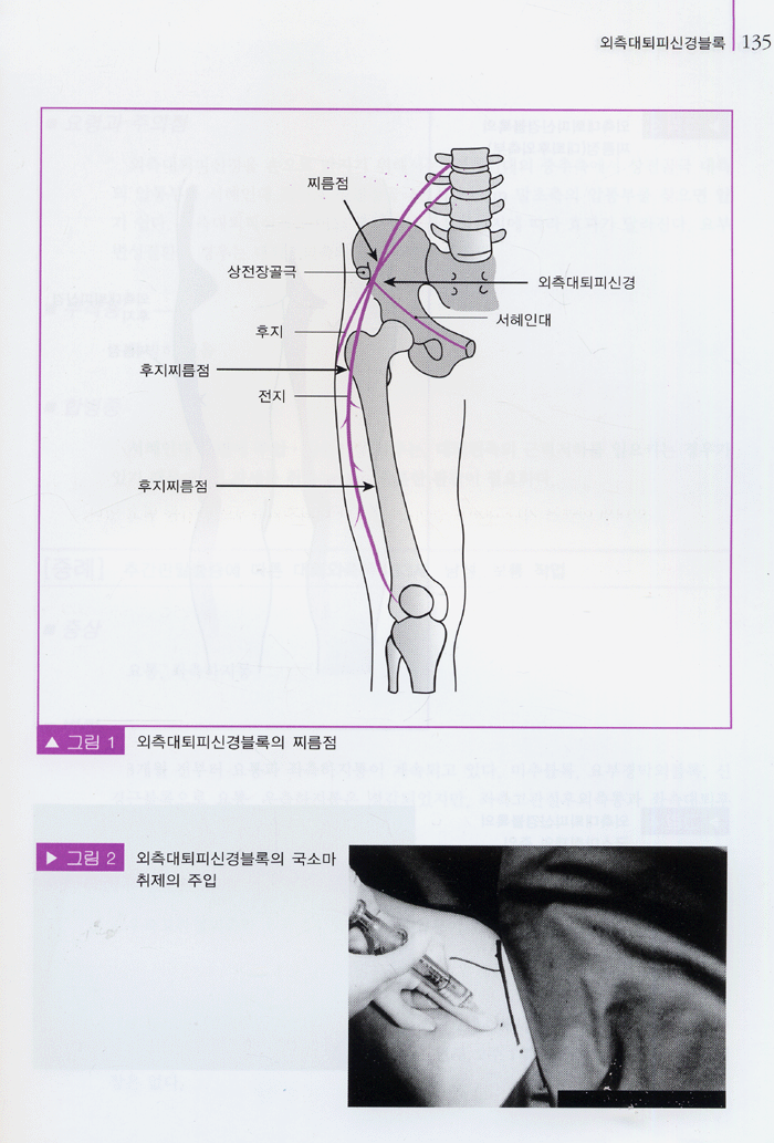 신경블록 테크닉 - 근골격계 질환 치료를 위한 -