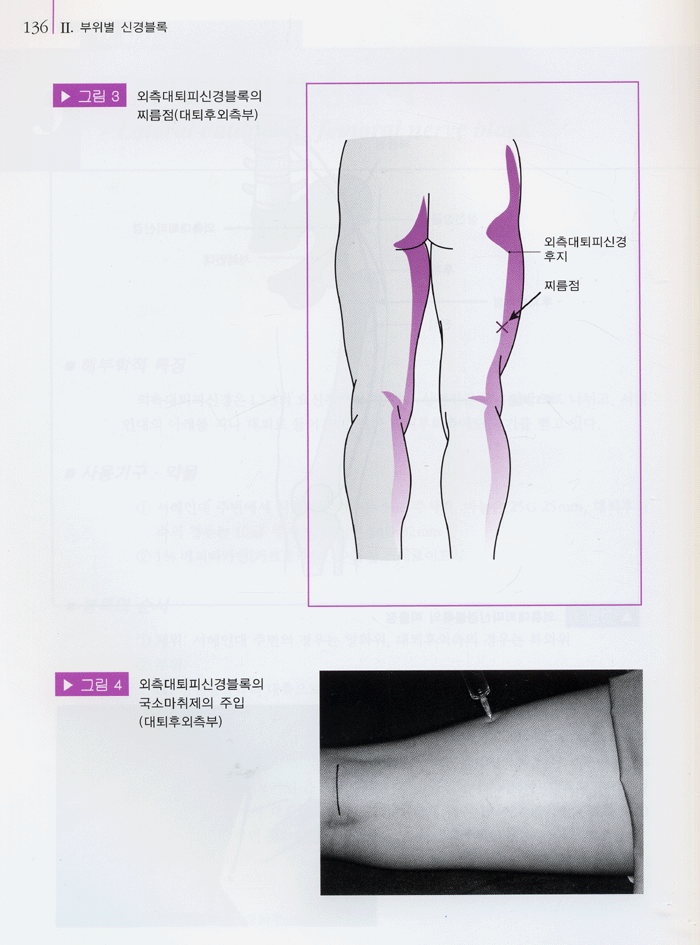 신경블록 테크닉 - 근골격계 질환 치료를 위한 -