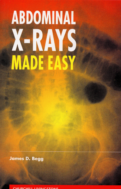 ABDOMINAL X-RAYS MADE EASY