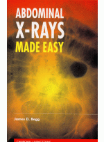 ABDOMINAL X-RAYS MADE EASY