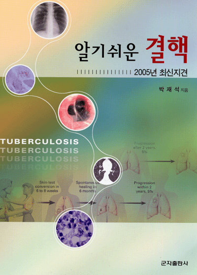 알기쉬운 결핵 2005년 최신지견