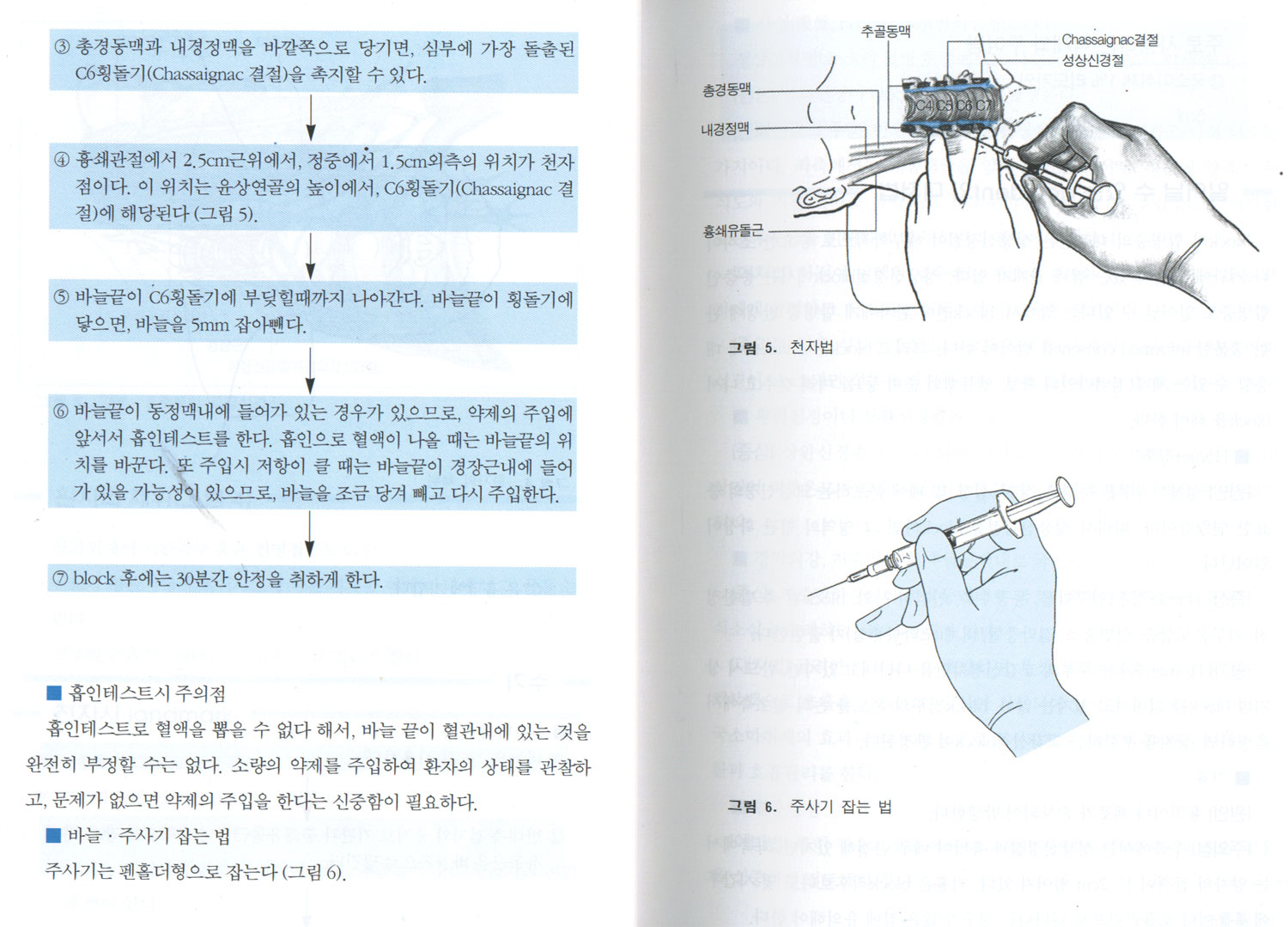 정형외과의를 위한 국소마취법 block요법 ABC