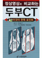 정상영상과 비교하는 두부 CT