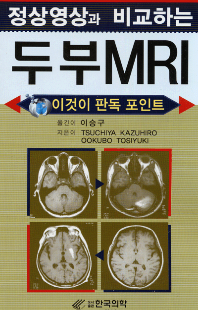 정상영상과 비교하는 두부MRI