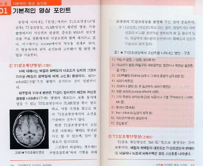 정상영상과 비교하는 두부MRI