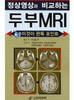 정상영상과 비교하는 두부MRI