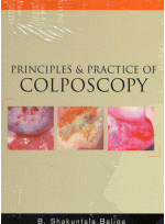 Principles and Practice of Colposcopy