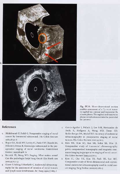 Atlas of Endoanal and Endorectal Ultrasonography