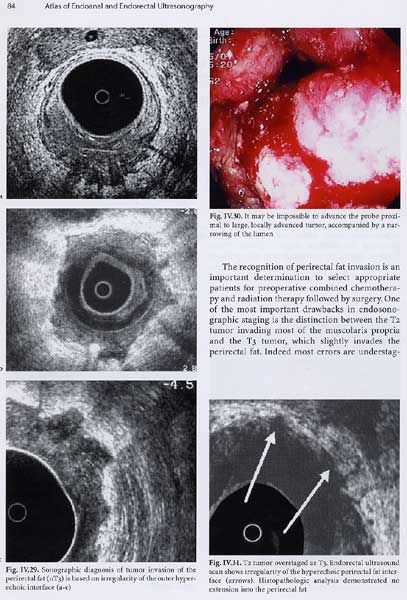 Atlas of Endoanal and Endorectal Ultrasonography