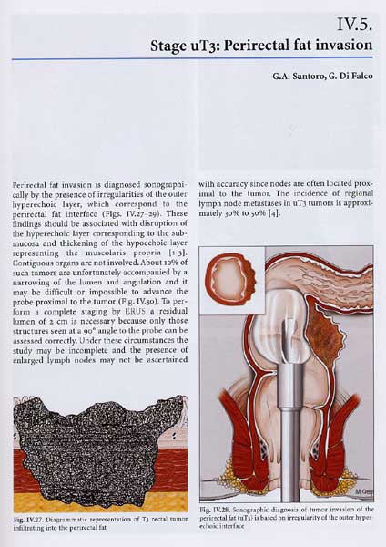 Atlas of Endoanal and Endorectal Ultrasonography