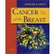 Cancer of the Breast