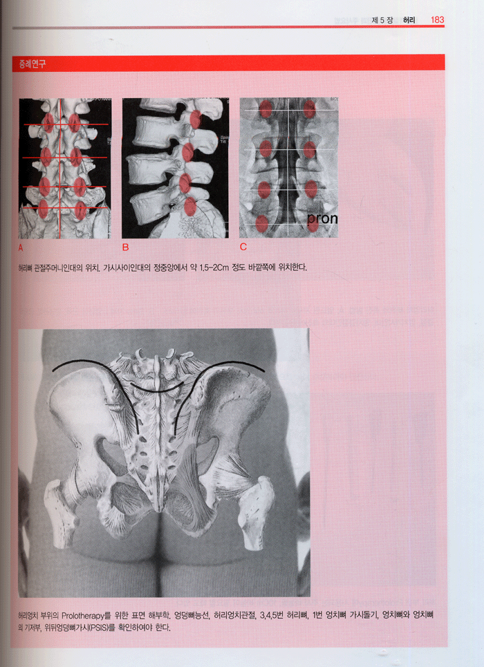 근골격질환의 진단과 주사요법-프롤로테라피의 임상적용(Diagnos