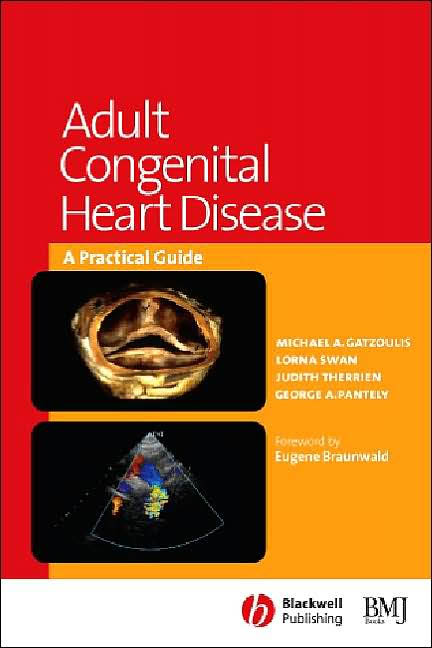 Adult Congenital Heart Disease