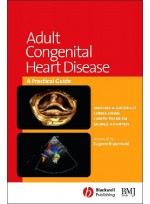 Adult Congenital Heart Disease