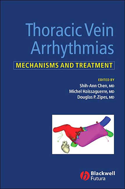 Thoracic Vein Arrythmias: Mechanisms and Treatment