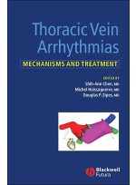 Thoracic Vein Arrythmias: Mechanisms and Treatment