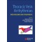 Thoracic Vein Arrythmias: Mechanisms and Treatment