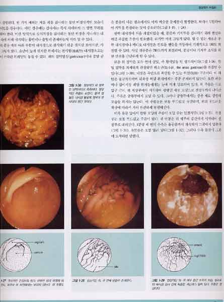 소화기내시경 검사 Gastrointestinal Endoscopy 3rd ed.