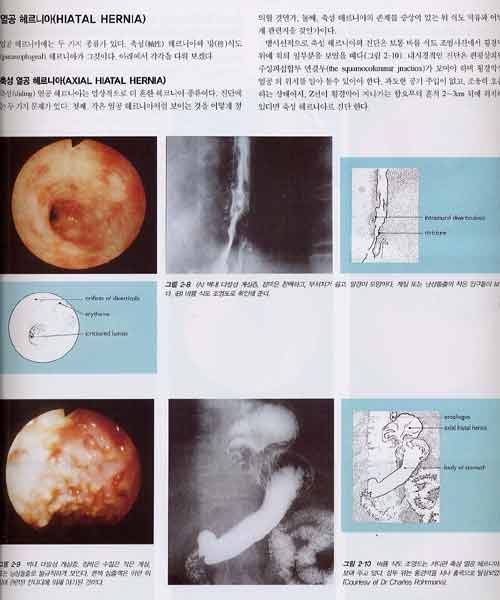 소화기내시경 검사 Gastrointestinal Endoscopy 3rd ed.