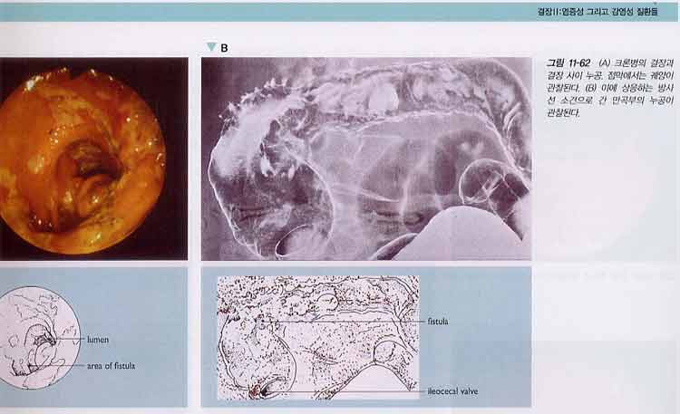 소화기내시경 검사 Gastrointestinal Endoscopy 3rd ed.