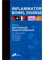 Inflammatory Bowel Diseases