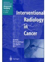 Interventional Radiology in Cancer