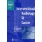 Interventional Radiology in Cancer