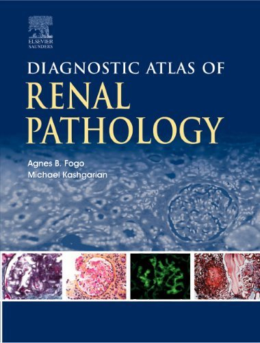Diagnostic Atlas of Renal Pathology: A Companion to Brenner