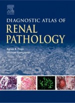 Diagnostic Atlas of Renal Pathology: A Companion to Brenner