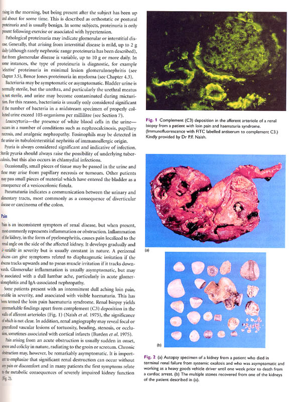 Oxford Textbook of Clinical Nephrology(3 Vol Set),3/e