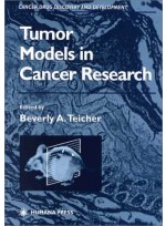 Tumor Models in Cancer Research