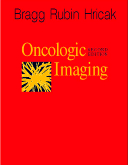 Oncologic Imaging, 2nd Edition