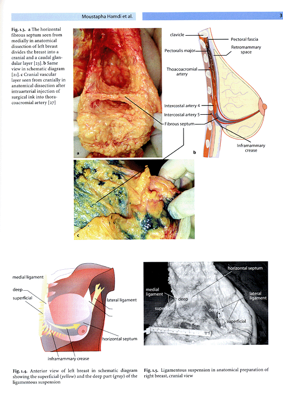 Vertical Scar Mammaplasty