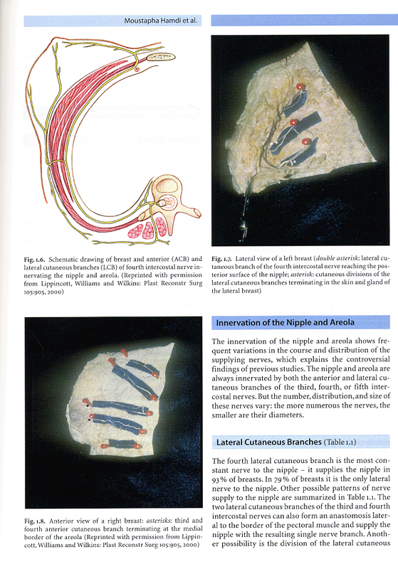 Vertical Scar Mammaplasty