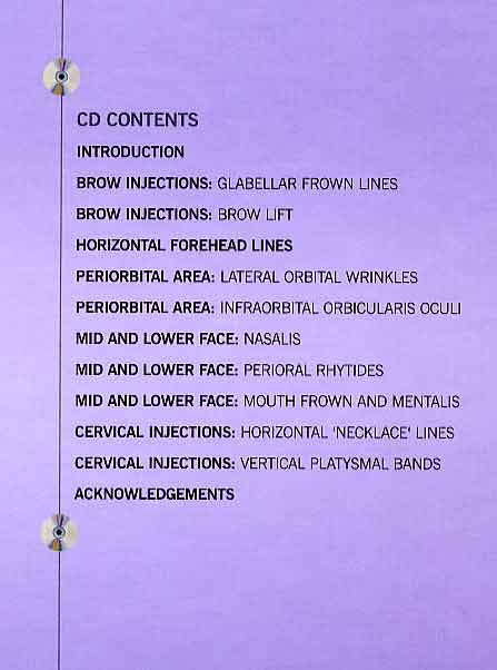 Using Botulinum Toxins Cosmetically : A Practical Guide CD-R