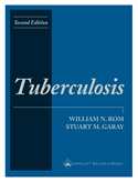 Tuberculosis