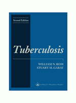 Tuberculosis