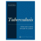 Tuberculosis