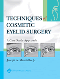 Techniques of Cosmetic Eyelid Surgery : A Case Study Approac