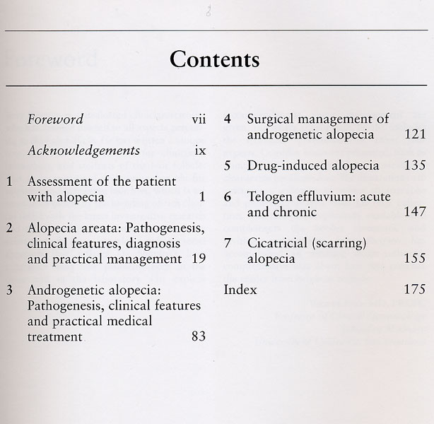 Hair Loss : Principles of Diagnosis and Management Alopecia