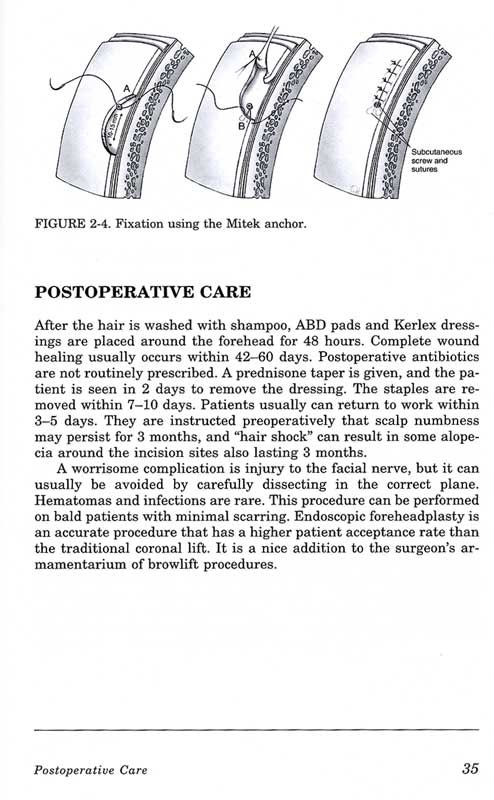 Gladstone and Nesi\'s Oculoplastic Surgery Atlas:Cosmetic Fac